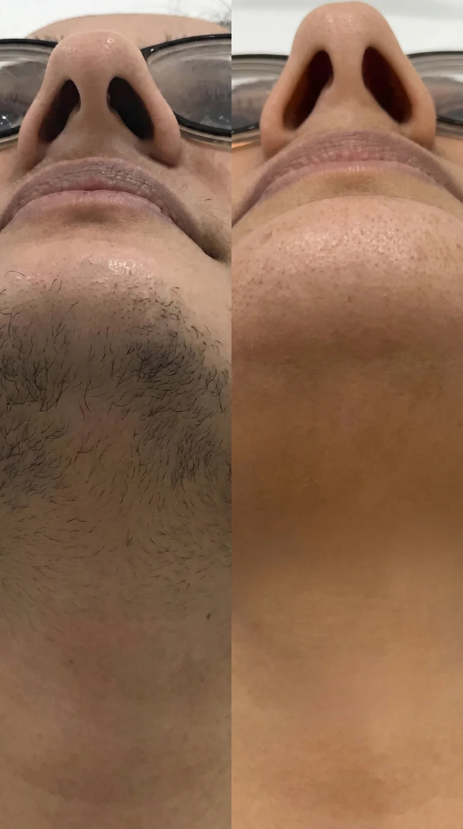 Antes y después de rutina