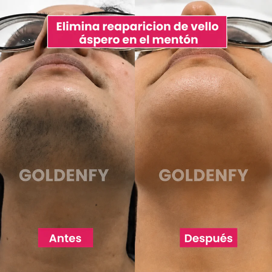 Mentón con rutina de cuidado